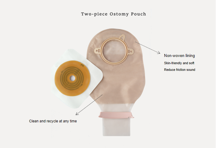 ostomy 