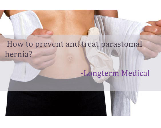 كيفية منع وعلاج الفتق parastomal؟